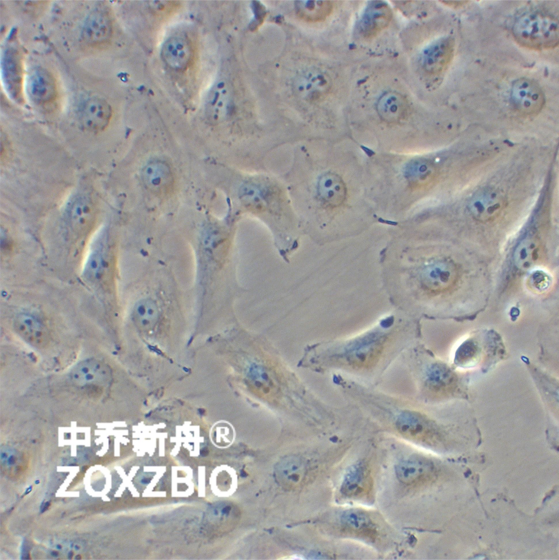 ECV-304人脐静脉内皮细胞（人膀胱癌细胞污染）