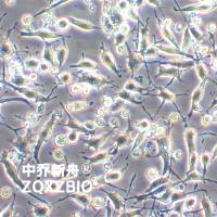 U14-GFP小鼠子宫颈癌细胞