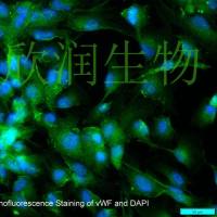 人心脏微血管内皮细胞系、永生化人心脏微血管内皮细胞、人心肌微血管内皮细胞系、永生化人心肌微血管内皮细胞、人心肌血管内皮细胞系