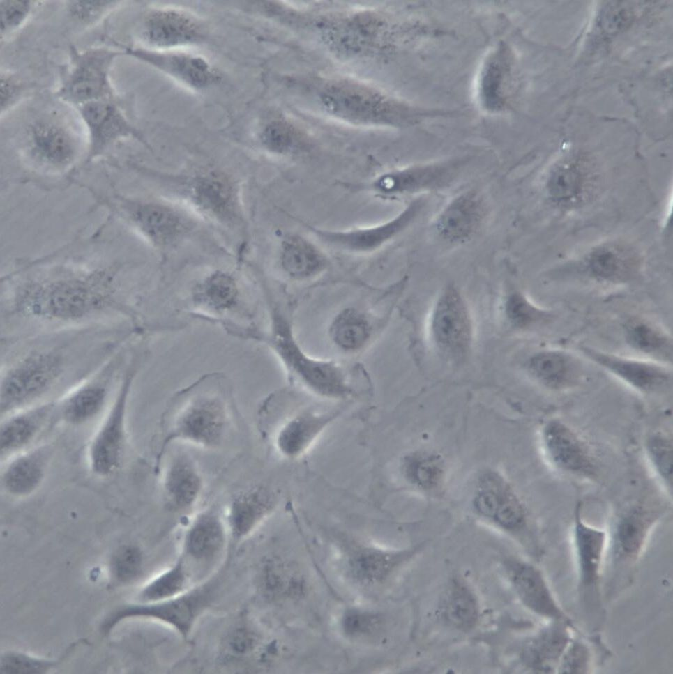 HUVEC-GFP、HUVEC-GFP细胞系、HUVEC-GFP细胞株、HUVEC-GFP人脐静脉血管内皮细胞-绿色标记 