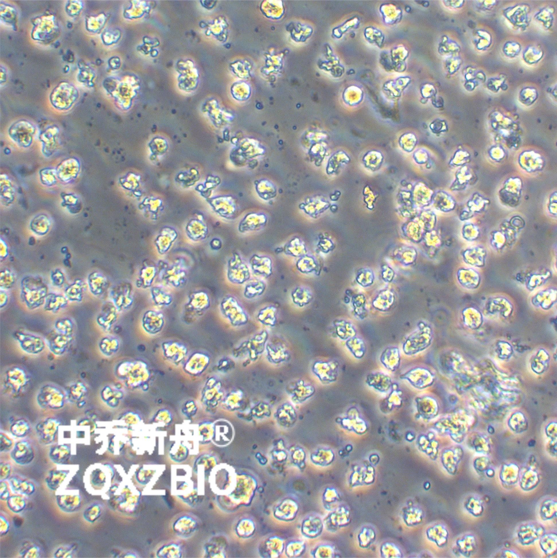 W6/32小鼠B细胞杂交瘤细胞