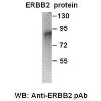 ErbB2 Polyclonal Antibody [TD-21202]