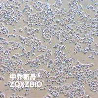 Anglne人卵巢癌细胞