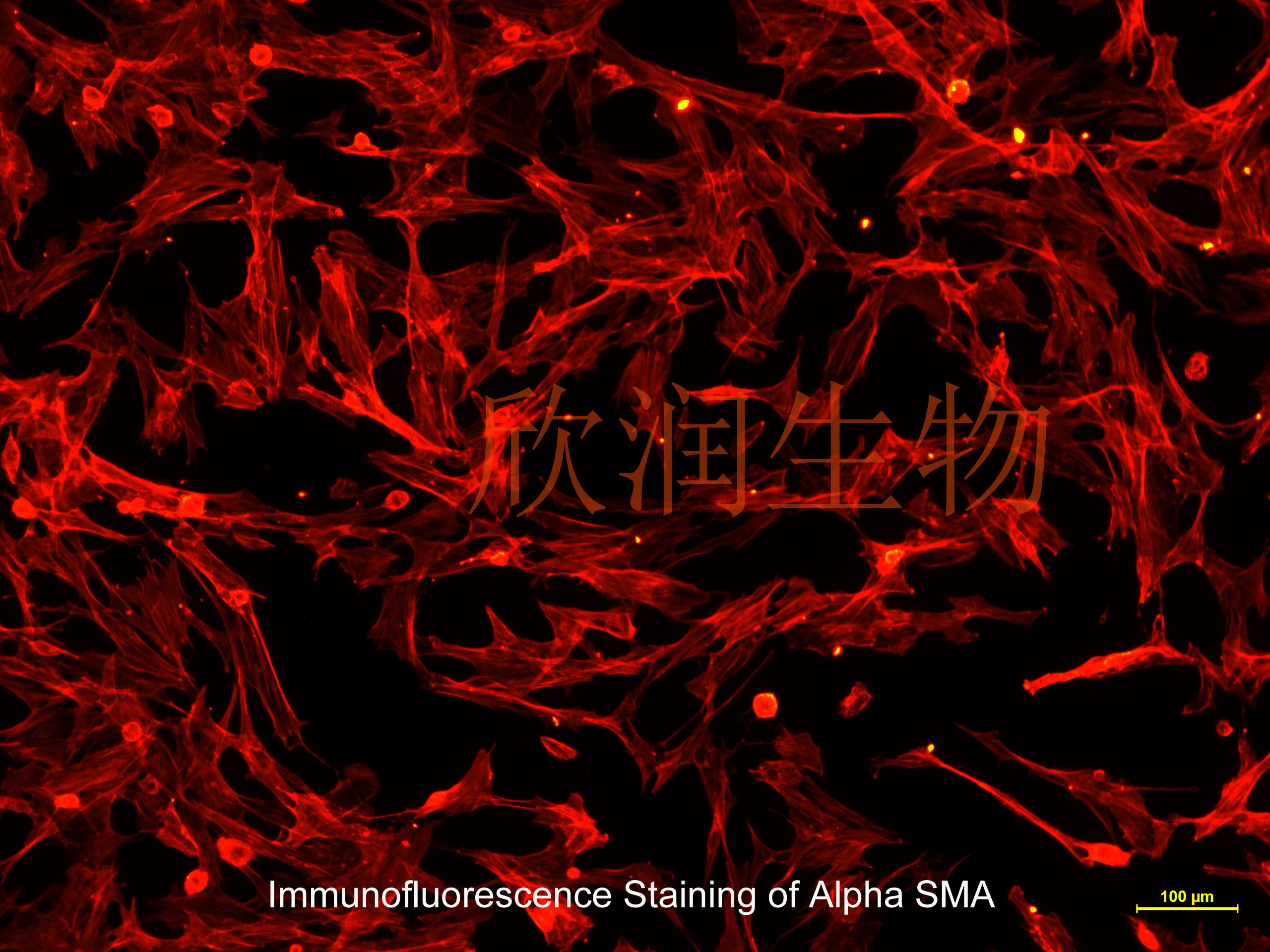 人子宫平滑肌细胞系、永生化人子宫平滑肌细胞