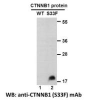 CTNNB1  (S33F)