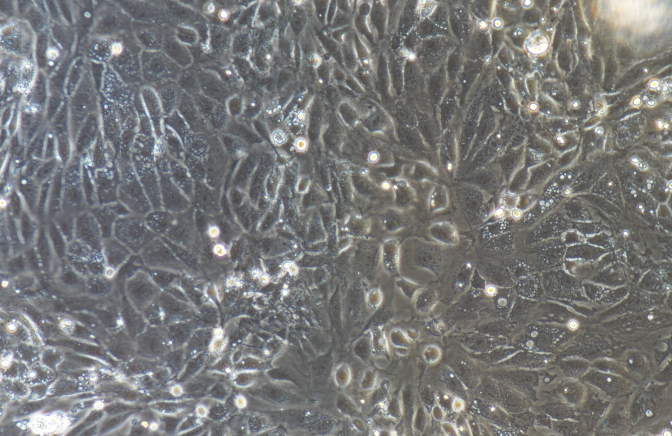 原代细胞分离培养方法 || 大鼠甲状旁腺细胞的分离培养