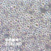 MM.1S人IgA-骨髓瘤细胞