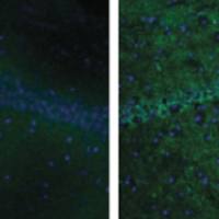 Fluoro-Jade C染色（绿色）