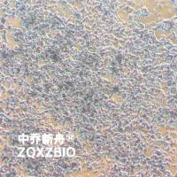 SK-N-BE(2)人神经母细胞瘤细胞