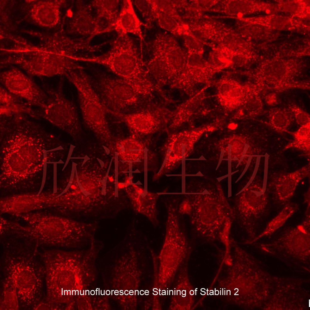 小鼠肝窦内皮细胞系、永生化小鼠肝窦内皮细胞