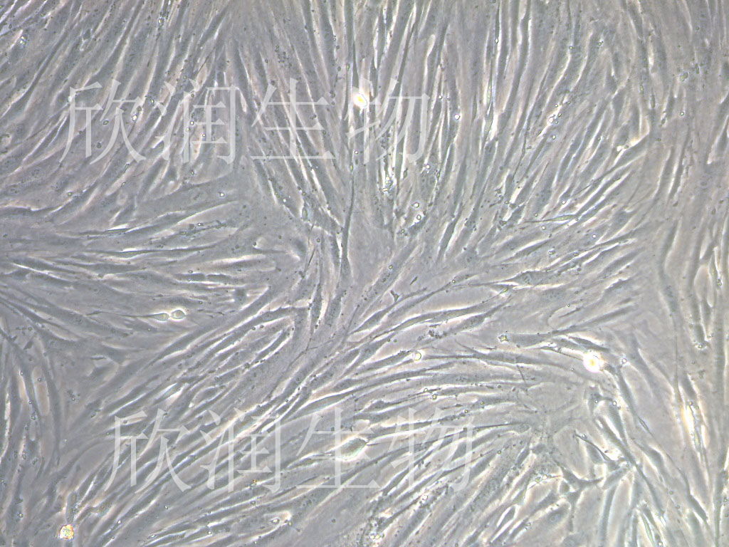 人子宫平滑肌细胞系、永生化人子宫平滑肌细胞
