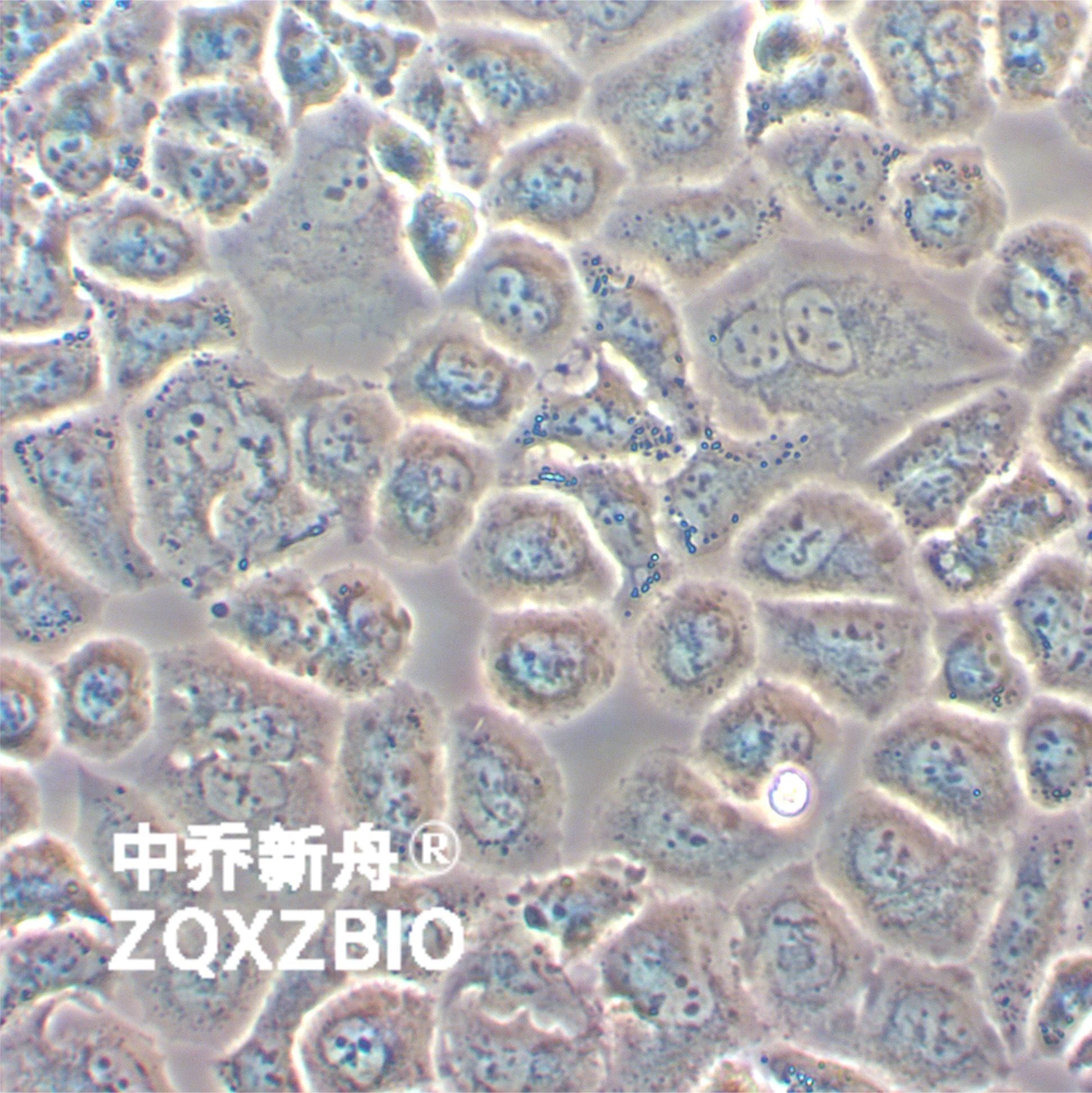 SW-13人肾上腺皮质小细胞癌细胞