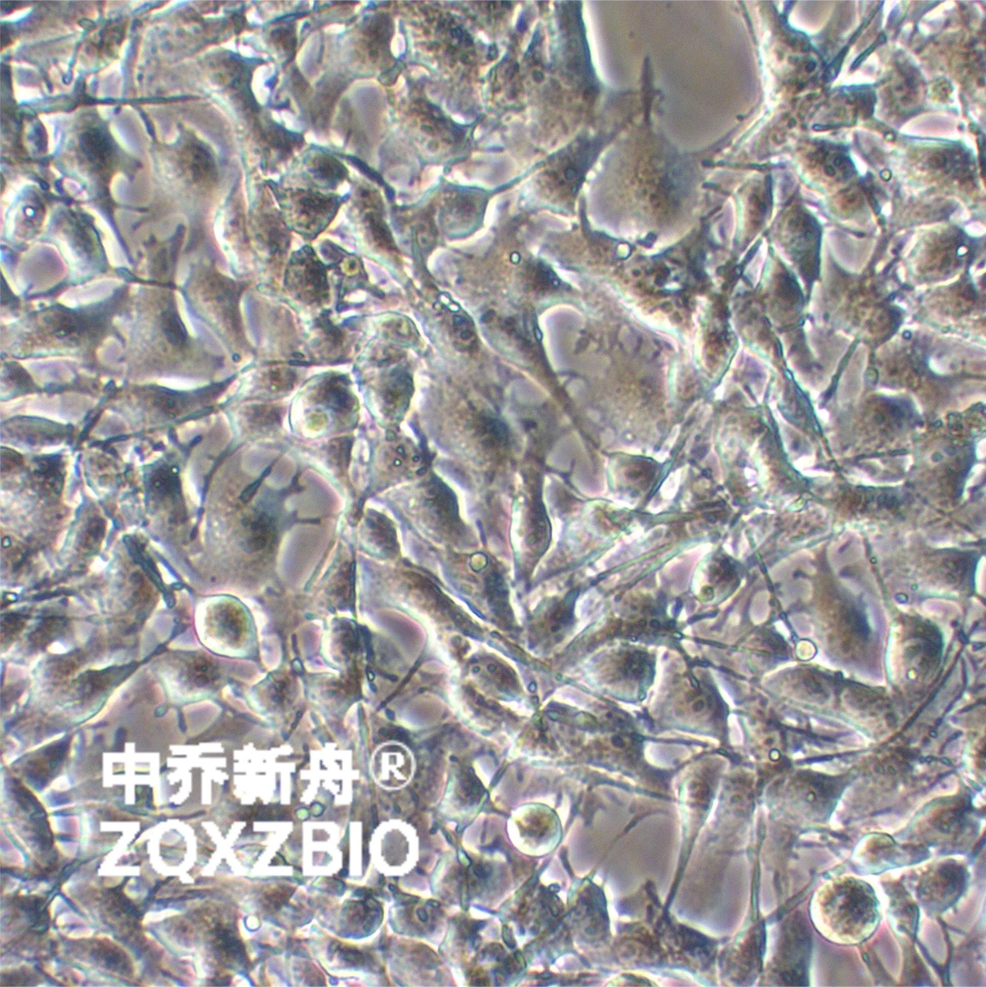B16-F1小鼠黑色素瘤细胞系