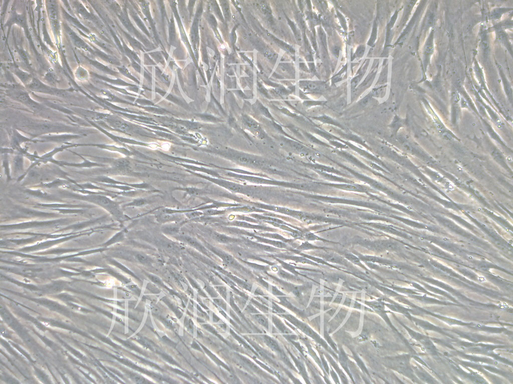 人子宫平滑肌细胞系、永生化人子宫平滑肌细胞