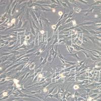 人BMSC细胞、hBMSCs人骨髓间充质干细胞系、永生化人骨髓间充质干细胞、人骨髓干细胞系