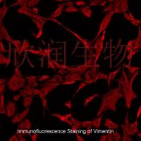 人心肌成纤维细胞系、永生化人心肌成纤维细胞、人心脏成纤维细胞系、永生化人心脏成纤维细胞