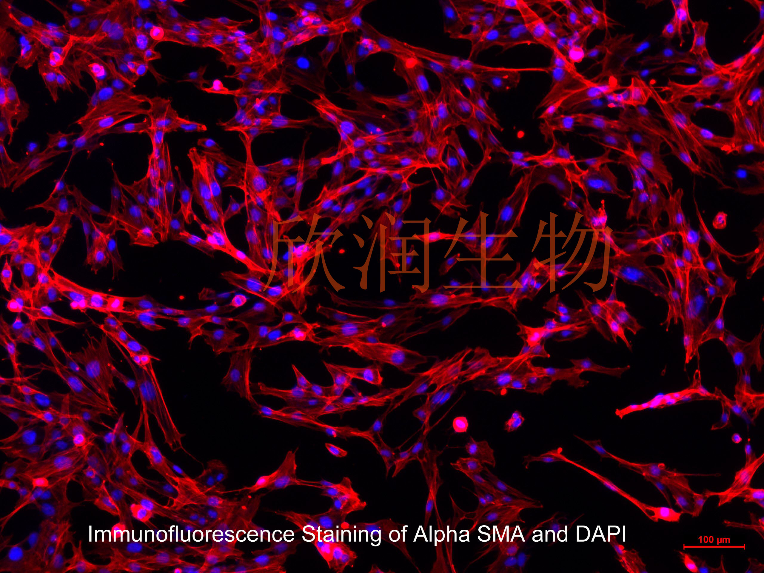 人子宫平滑肌细胞系、永生化人子宫平滑肌细胞