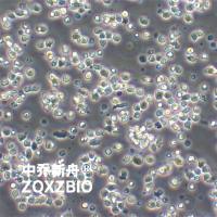 Farage人B淋巴瘤细胞系