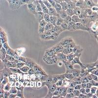 CAL 27人舌鳞癌细胞