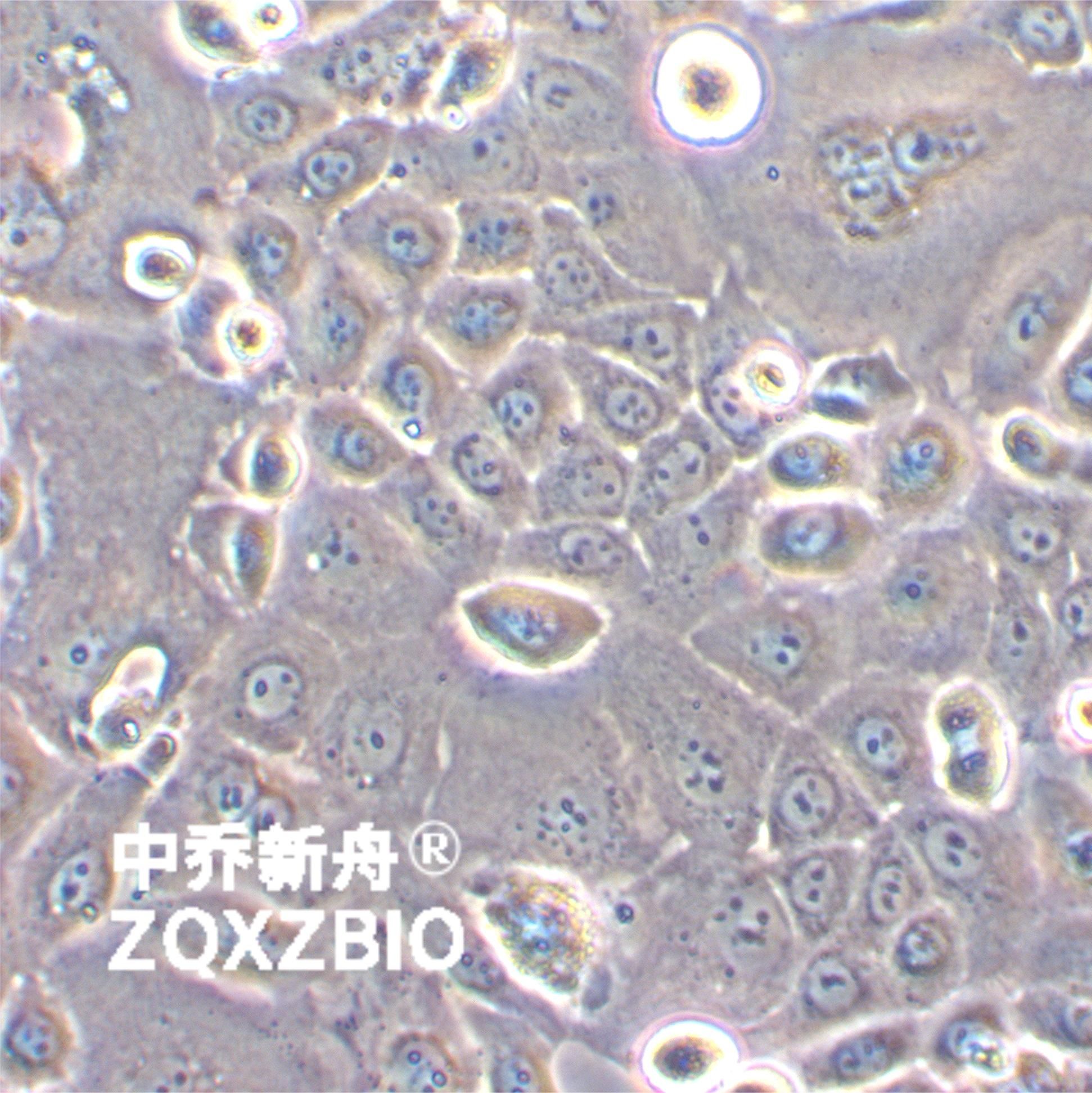 KLE人子宫内膜癌细胞