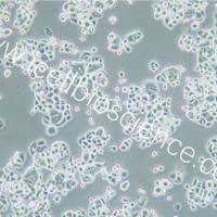 ZR-75-30 人乳腺癌细胞/STR鉴定/镜像绮点（Cellverse）