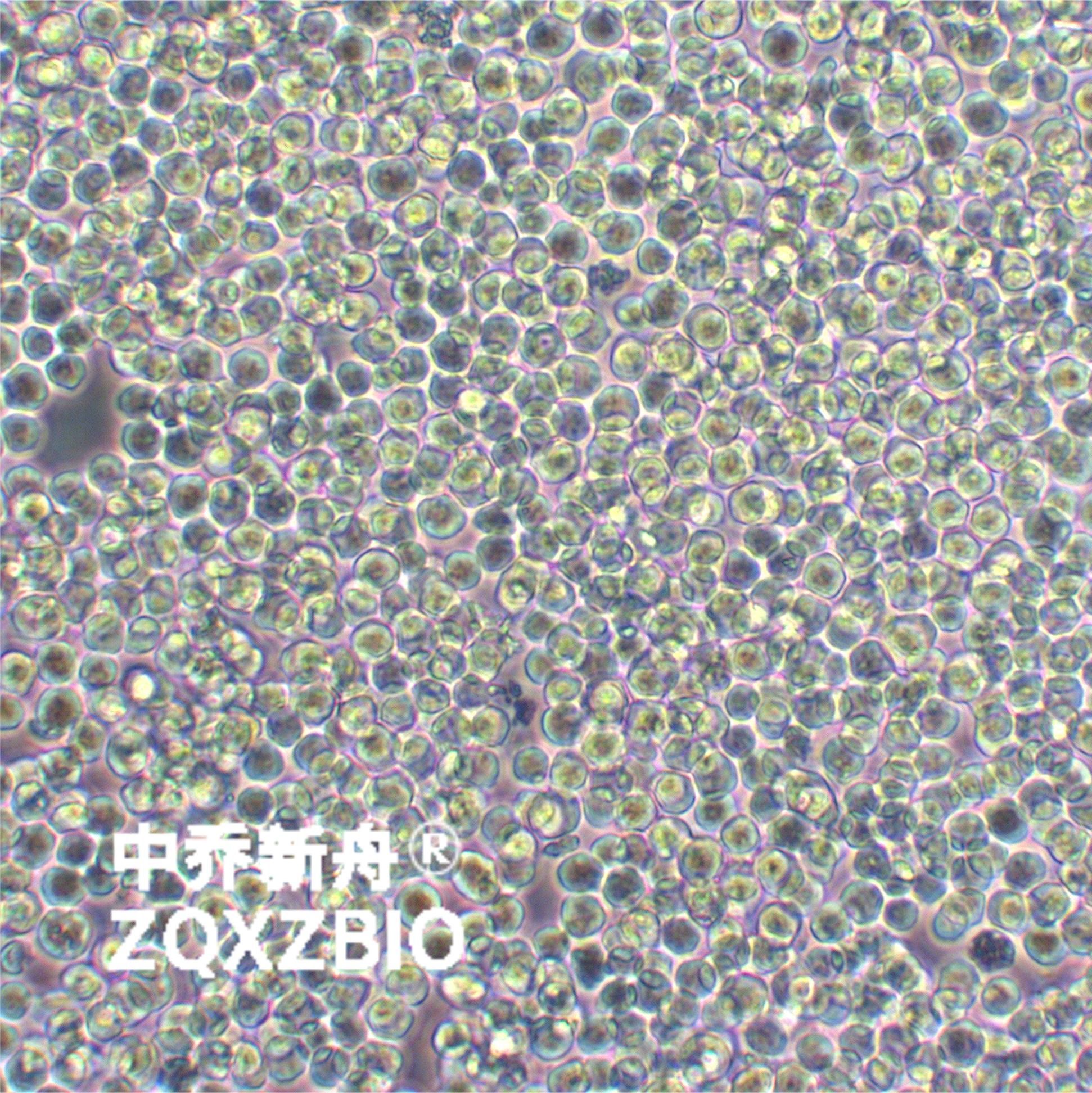 MOLT-4人急性淋巴母细胞白血病细胞