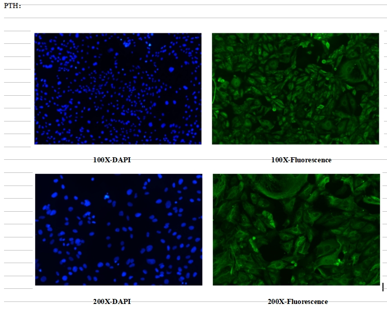 原代细胞分离培养方法 || 大鼠甲状旁腺细胞的分离培养