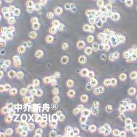 Burkitts淋巴瘤细胞系