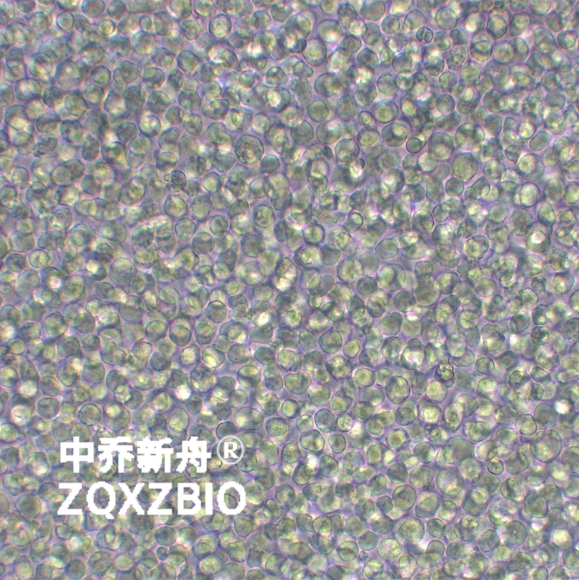 HMy2.CIR人B淋巴母细胞