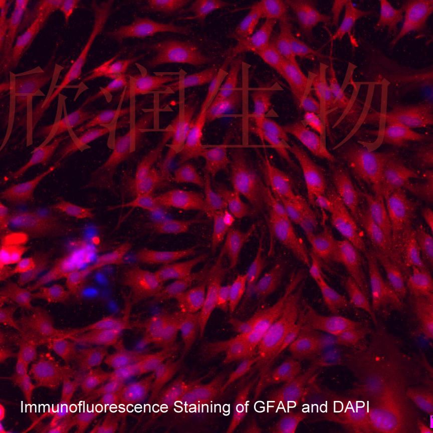 小鼠脑星形胶质细胞系、永生化小鼠脑星形胶质细胞