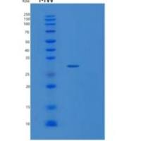 人沉默调节蛋白3(SIRT3)重组蛋白