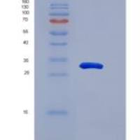 人Snail同源物1(SNAI1)重组蛋白