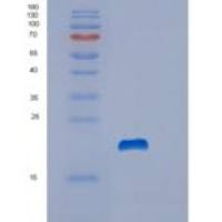 人Stathmin重组蛋白