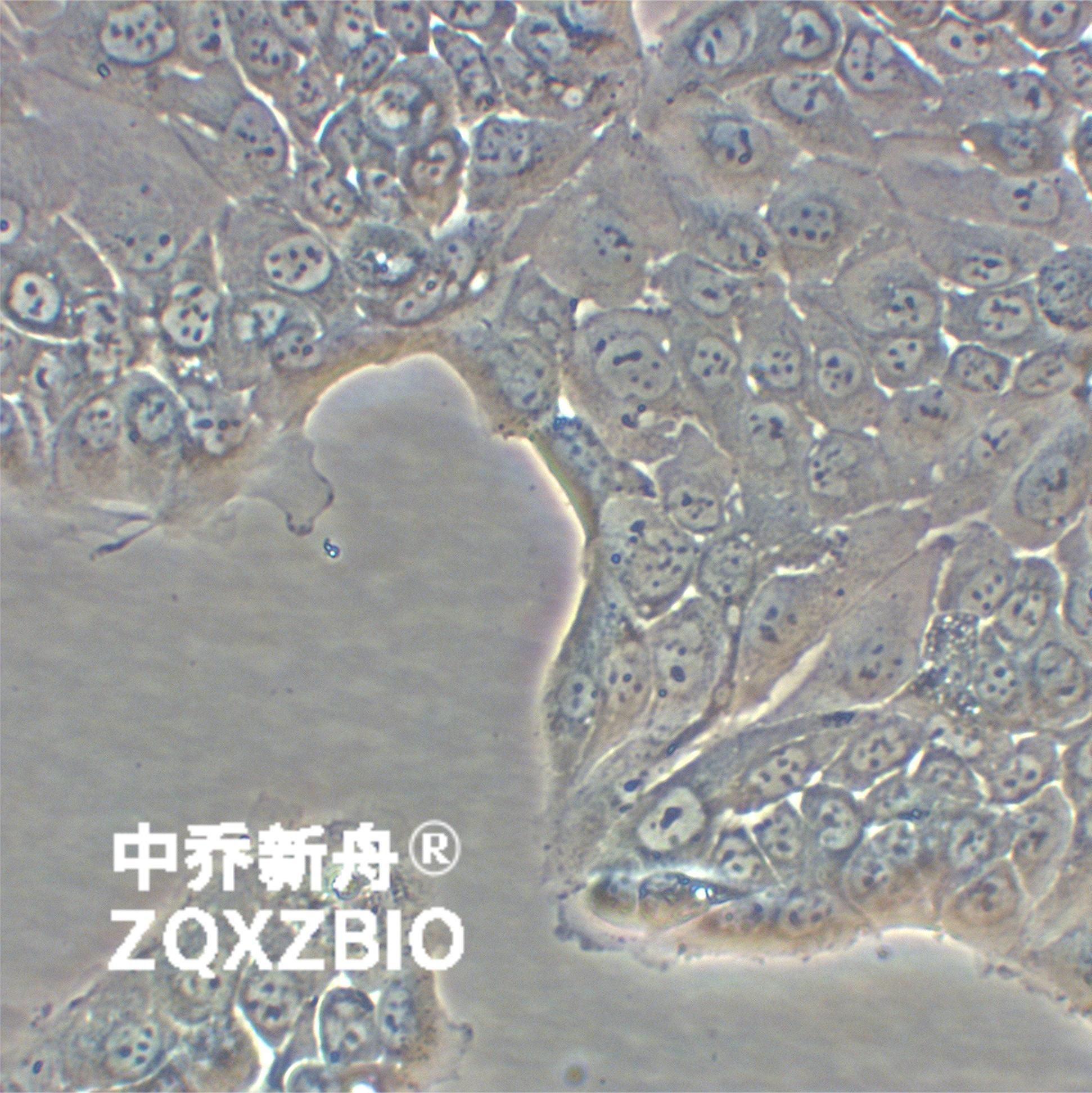 HPAF-II人胰腺癌细胞