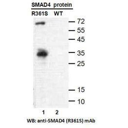 SMAD4 (R361S)