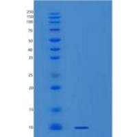 人小核糖核蛋白多肽G(SNRPG)重组蛋白