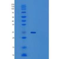 人抗药蛋白(SRI)重组蛋白