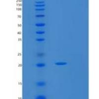 大肠杆菌SlyD重组蛋白