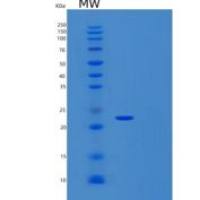 人含硬化蛋白域蛋白1(SOSTDC1)重组蛋白