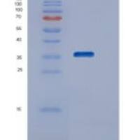 人STK16重组蛋白