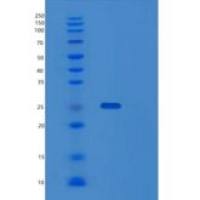 人SPSB1重组蛋白