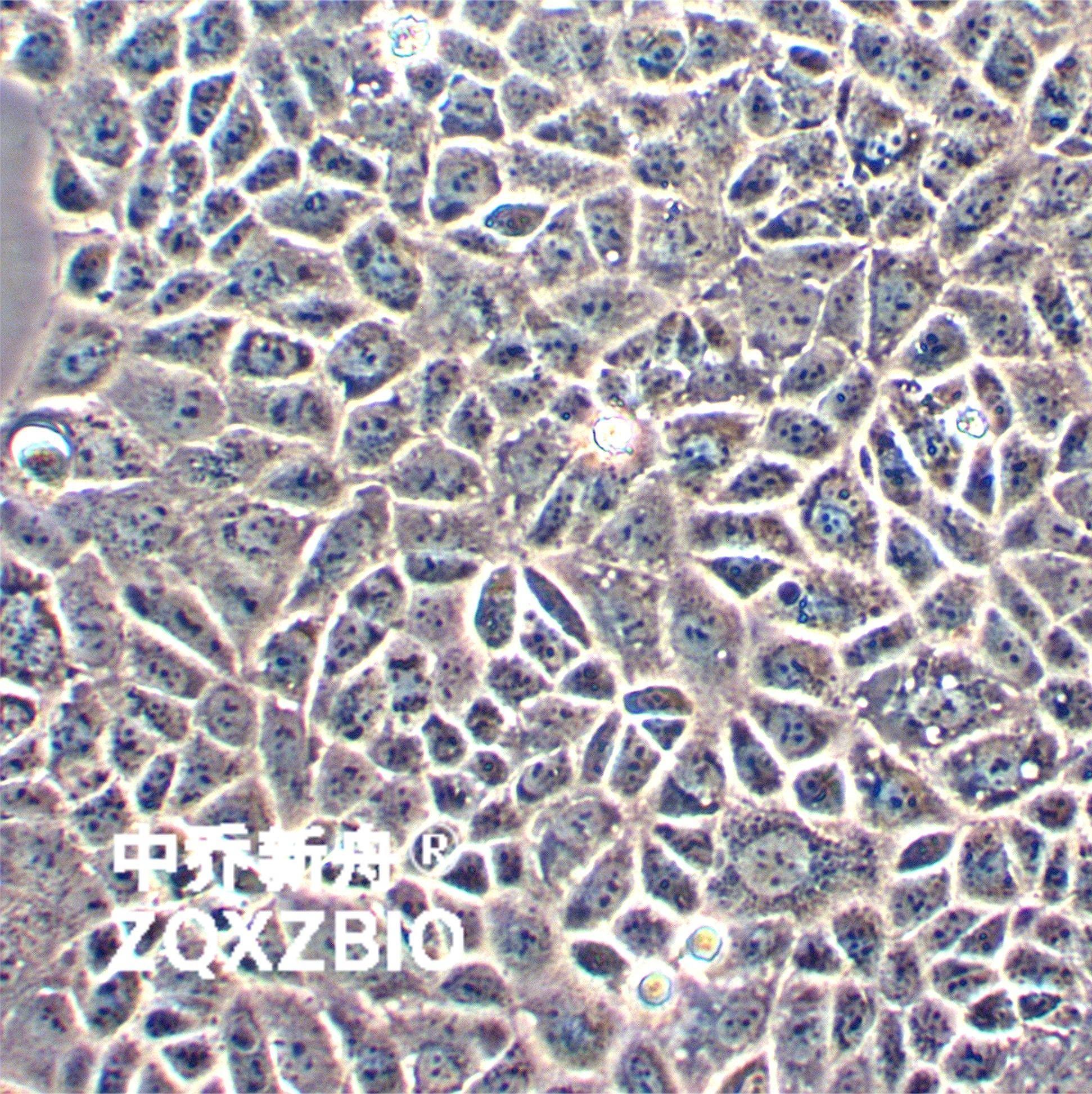 CAL-51人乳腺癌细胞