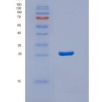 人STARD5重组蛋白