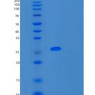 人SNRPB2重组蛋白