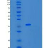 人SNRPB2重组蛋白