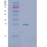 人信号淋巴细胞激活分子家族成员6(SLAMF6)重组蛋白