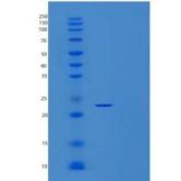 人性别决定区Y框蛋白2(SOX2)重组蛋白