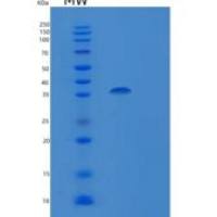 人亚精胺合酶(SRM)重组蛋白