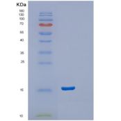 人胞浆磷蛋白2(STMN2)重组蛋白