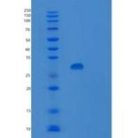 人沉默调节蛋白5(SIRT5)重组蛋白